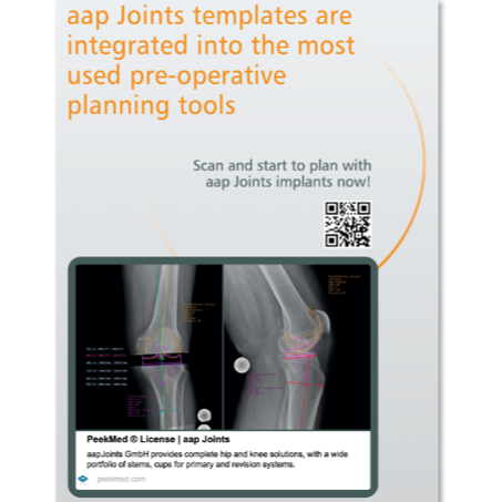 New Technologies for pre-operative planning and smart guided navigation ...