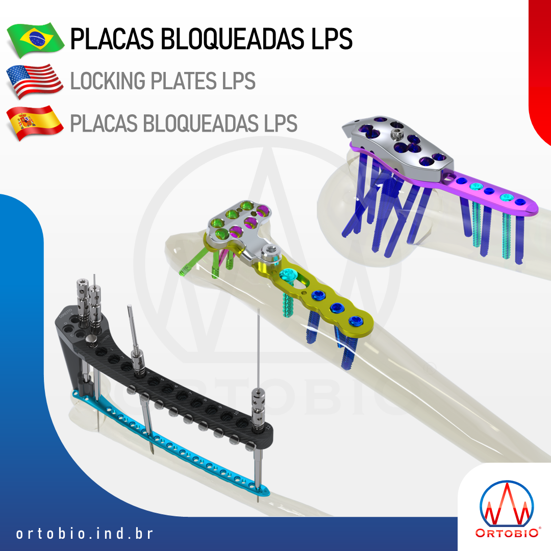 LPS Locking Plate System