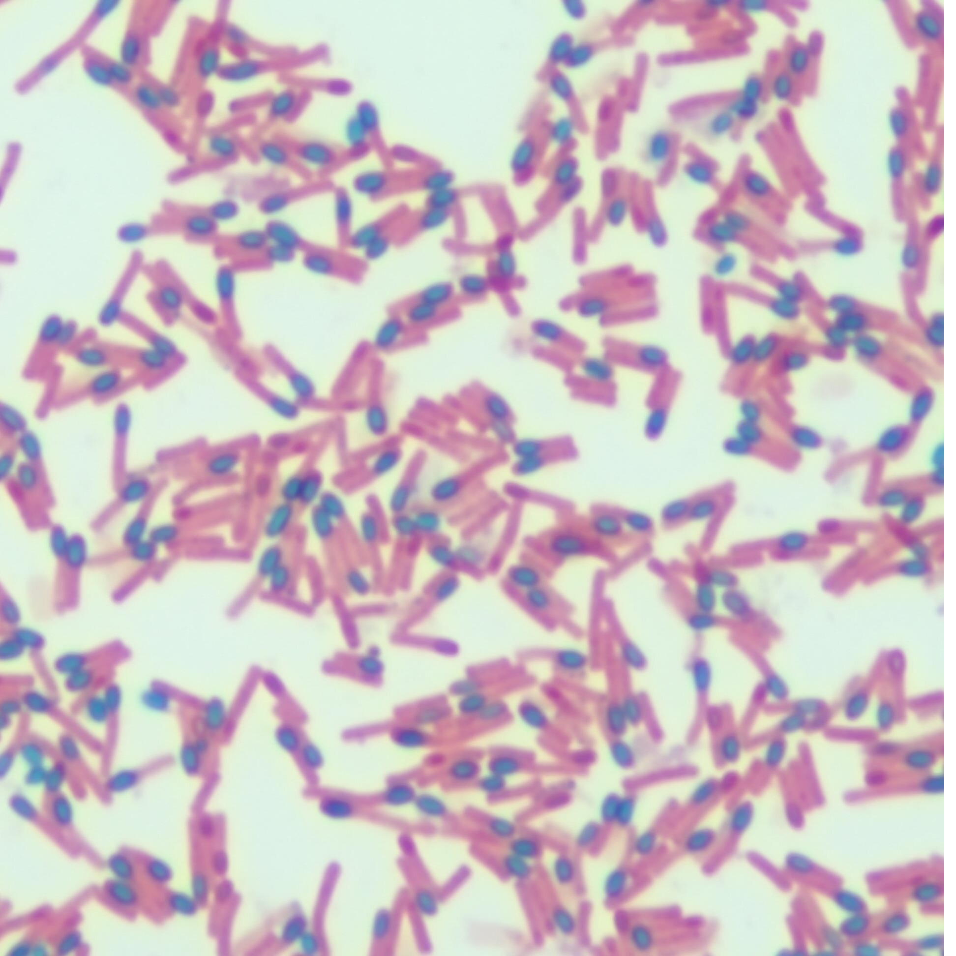 Does Bacillus Coagulans Help With Yeast Infections Bacillus coagulans